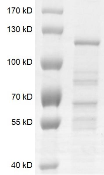 Recombinant TET2 (1129-2002) protein gel. Recombinant TET2 (1129-2002) protein was run on an 8% SDS-PAGE gel and stained with Coomassie blue.