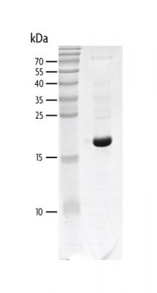 Recombinant CECR2 (425-538) protein gel. CECR2 (425-538) protein was run on an SDS-PAGE gel and stained with Coomassie blue.
