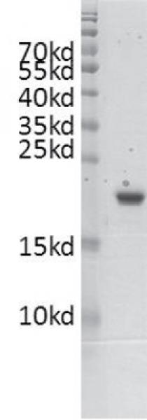Recombinant ASH1L (2407-2579) protein gel. ASH1L (2407-2579) protein was run on a 10% SDS-PAGE gel and stained with Coomassie blue.