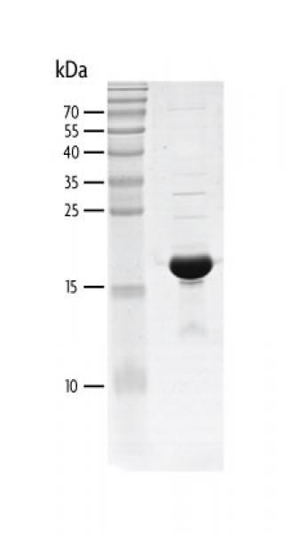 Recombinant CREBBP (1081-1197) protein gel. CREBBP (1081-1197) protein was run on an SDS-PAGE gel and stained with Coomassie blue.