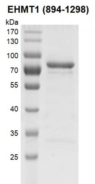 Recombinant EHMT1 (894-1298) SDS-PAGE gel. Recombinant EHMT1 was run on a 12. 5% SDS-PAGE gel and stained with Coomassie Blue.