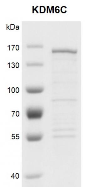 Recombinant KDM6C protein gel. KDM6C protein was run on an 8% SDS-PAGE gel and stained with Coomassie Blue.