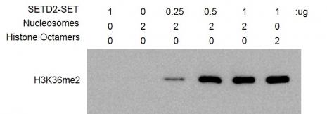 HMT Assay for Recombinant SETD2 (1392-2564) protein activity. 2 µg recombinant nucleosomes were incubated with SETD2 (1392-2564) in reaction buffer for 3 hr at RT. Western blot was used to detect reaction products (H3K36me2 Antibody, Cat# 39891). SETD2 (1392-2564) alone was used as negative control.