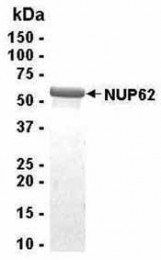 Analysis of NUP62 Recombinant Protein. 4-20% SDS gradient gel. Coomassie blue staining. ( anti-NUP62 protein ) NUP62 protein SDS image