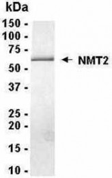 Analysis of NMT2 Recombinant Protein. 4-20% SDS gradient gel. Coomassie blue staining. ( anti-NMT2 protein ) NMT2 protein SDS image