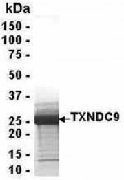 Analysis of TXNDC9 Recombinant Protein. 4-20% SDS gradient gel. Coomassie blue staining. ( anti-TXNDC9 protein ) TXNDC9 protein SDS image