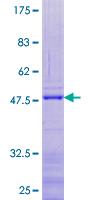 Ribosomal Protein L24 Recombinant Protein [H00006152-P01]