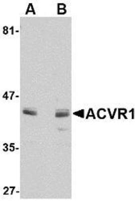 Western Blot: Activin A Receptor Type I Peptide [NBP1-76352PEP] - blocks the antibody activity completely in Western blot by incubating the peptide with equal volume of antibody for 30 min at 37C.