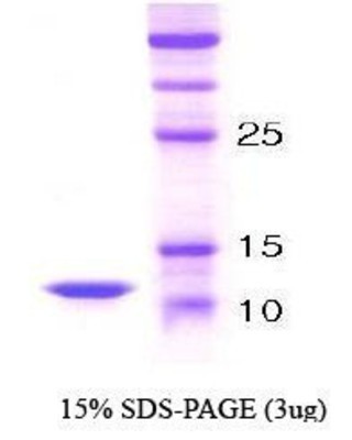 SDS-Page:Parathyroid Hormone Protein [NBC1-18448] - Parathyroid Hormone, 9.55 kDa (85 aa), confirmed by MALDI-TOF with a purity of 95% by SDS - PAGE
