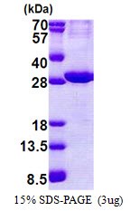 SDS-Page: ATPase Na+/K+ beta 2 Protein [NBP2-22701]