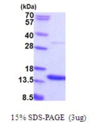 SDS-Page: C11orf67 Recombinant Protein [NBP2-51876] - 15% SDS Page (3 ug)