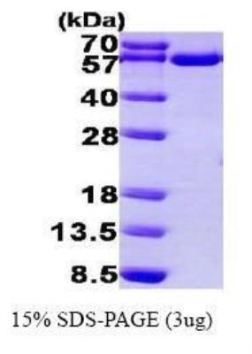SDS-Page: Recombinant Human Thioredoxin Reductase 1/TRXR1 Protein [NBP1-44456]