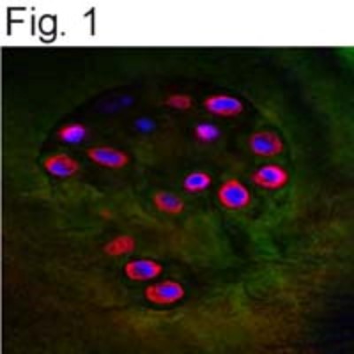 Immunocytochemistry/Immunofluorescence: Aggrecan Peptide [NB100-74350PEP] - Immunostaining of OA cartilage.