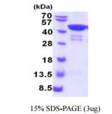 SDS-Page: Recombinant Human Troponin T Type 2 (cardiac) Protein [NBC1-28765]