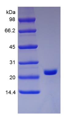 SDS-Page: Human sRank Receptor/TNFRSF11A Protein [NBP2-35272]