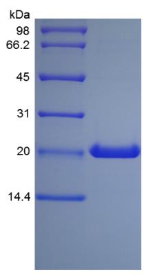 SDS-Page: Human Growth Hormone Protein [NBP2-34890]
