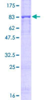 SDS-Page: Perforin Recombinant Protein [H00005551-P01]