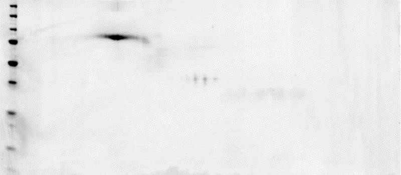 Western Blot: p75NTR/NGF Receptor Protein [NBP1-46099] - A sample of NGF R (209 aa) - Fc Chimera without carrier protein was reduced and alkylated and focused on a 3-10 IPG strip then run on a 4-20% Tris-HCl 2D gel. 40 ug protein loaded per lane; Deep Purple&#8482; stained. Spot train indicates presence of multiple isoforms of NGF R (209 aa) - Fc Chimera. Spots within the spot train were cut from the gel and identified as NGF R (209 aa) - Fc Chimera by protein mass fingerprinting.