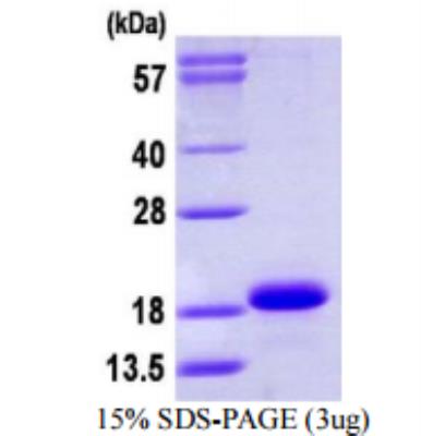 SDS-Page: Cytochrome b5 type A Recombinant Protein [NBP1-72422]
