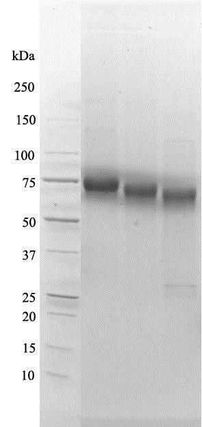 Western Blot: p75NTR/NGF Receptor Protein [NBP1-46099] - Lane 1 - MW markers; Lane 2 - NGF R (209 aa) - Fc Chimera; Lane 3 - NGF R (209 aa) - Fc  Chimera treated with PNGase F to remove potential N-linked glycans; Lane 4 - NGF R (209 aa) - Fc Chimera treated with a glycosidase cocktail to remove potential N- and O-linked glycans. 10 ug protein loaded per lane; Deep Purple&#8482; stained. Drop in MW after treatment with PNGase F indicates presence of N-linked glycans. Subsequent drop in MW after treatment with glycosidase cocktail indicates the presence of O-linked glycans. Faint bands in lane 3 and lane 4 are glycosidase enzymes.