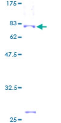 SDS-Page: Aurora A Recombinant Protein [H00006790-P01]