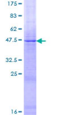 Recombinant Human Factor VIII Protein [H00002157-P01] - 12.5% SDS-PAGE Stained with Coomassie Blue.