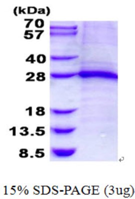 SDS-Page: Troponin I Type 1 (slow skeletal) Protein [NBP2-22892]