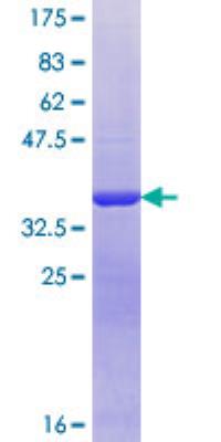 SDS-Page: Sulfatase Modifying Factor 1/SUMF1 Partial Recombinant Protein [H00285362-Q01]
