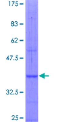 Recombinant Human Natriuretic Peptide Receptor C Protein [H00004883-Q01] - 12.5% SDS-PAGE Stained with Coomassie Blue.
