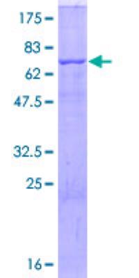 Recombinant Human CD36/SR-B3 Protein [H00000948-P02] - 12.5% SDS-PAGE Stained with Coomassie Blue.