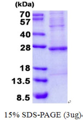 SDS-Page: Troponin I type 2 (fast skeletal) Protein [NBP2-22893]