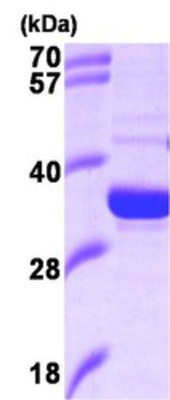Western Blot: Heme oxygenase 2 Protein [NBP1-37089] - 15% SDS-PAGE (3ug)