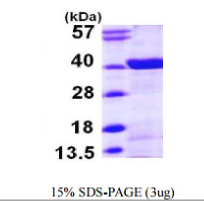 SDS-Page: N myc interactor Recombinant Protein [NBP1-50958]