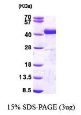 SDS-Page: Sorbitol Dehydrogenase Protein [NBP1-44460] - SORD, 40.4 kDa (377aa) confirmed by MALDI-TOF with a purity of 90% by SDS - PAGE