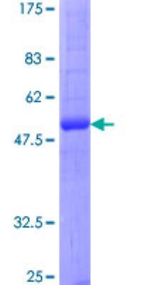 Recombinant Human Aquaporin-2 Protein [H00000359-P01] - 12.5% SDS-PAGE Stained with Coomassie Blue.