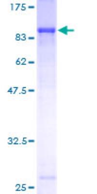 SDS-Page: Secretory Component / ECM1 Recombinant Protein [H00001893-P01] - 12.5%, Stained with Coomassie Blue.