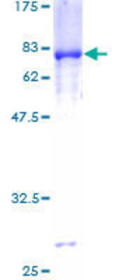 12.5% SDS-PAGE Stained with Coomassie Blue.