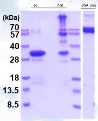 SDS-Page: PA28 Activator alpha Subunit/PSME1 Recombinant Protein [NBP1-49437] - 15% SDS-PAGE LoadingR: reducing sample bufferNR: non-reducing sample buffer
