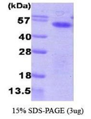 SDS-Page: Aurora A Protein [NBC1-28779] - Aurora kinase A, 47.9 kDa (423aa) with a purity of 95% by SDS - PAGE