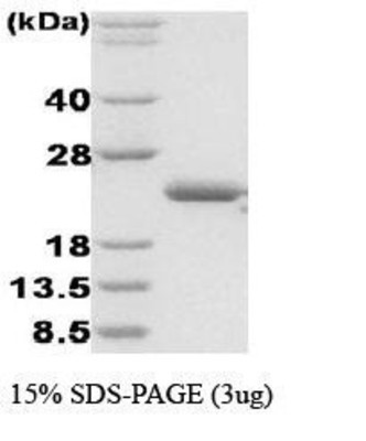 SDS-Page: Disulfide oxidoreductase Protein [NBC1-18365] - DsbA, 21.1kDa (189aa), confirmed by MALDI-TOF with a purity of 95% by SDS - PAGE
