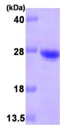 Western Blot: Cysteine Dioxygenase Type 1 Protein [NBP1-30241] - 15% SDS-PAGE (3ug)