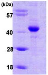 SDS-Page: Factor Inhibiting HIF-1 Protein [NBC1-22596] - 15% SDS-PAGE (3 ug).