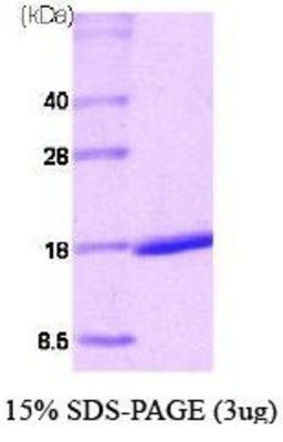 SDS-Page: Retinoic Acid Receptor alpha Protein [NBC1-22578] - RARa, 14 kDa (127 aa), confirmed by MALDI-TOF with a purity of 95% by SDS - PAGE