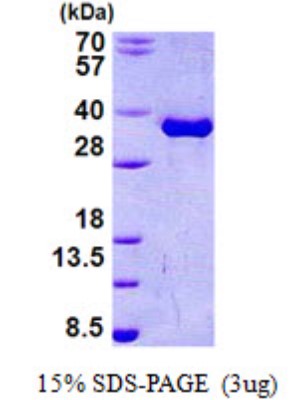 SDS-Page: Torsin A Protein [NBP2-22872]