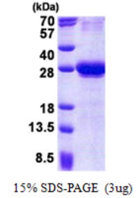 SDS-Page: Coxsackie Adenovirus Receptor Protein [NBP2-22802]