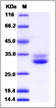 SDS-PAGE analysis of human EPDR1 protein (His Tag)