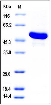 SDS-PAGE analysis of human GBA3 His tag protein