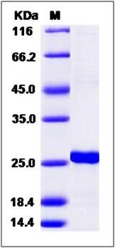 SDS-PAGE analysis of Human RGS5 protein (His Tag)