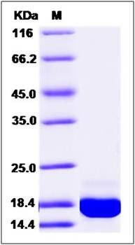 SDS-PAGE analysis of Human PFDN1 protein (His Tag)