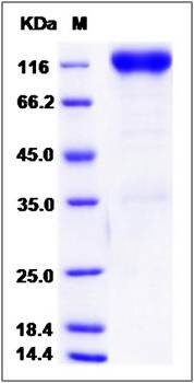 SDS-PAGE analysis of Rat PDGFRB protein